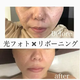 美肌脱毛と癒しのﾌﾟﾗｲﾍﾞｰﾄｻﾛﾝ。gratia~ｸﾞﾚｲﾃｨｱ~所属・gratia ~ｸﾞﾚｲﾃｨｱ~のエステ・リラクイメージ