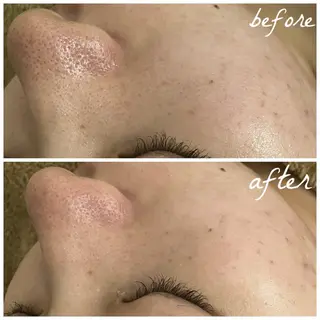 メンズ メナード岐阜市茜部 杉浦のエステ・リラクイメージ