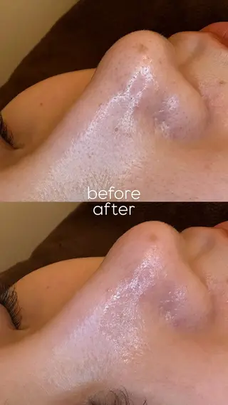 EARTH coiffure beaute 新潟紫竹山店所属・🤍アベシュリ /フェイシャル🤍のエステ・リラクイメージ