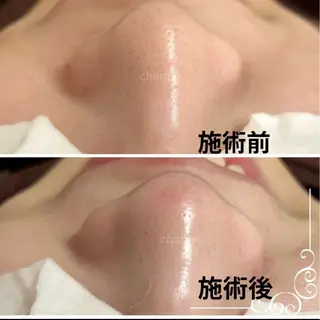 佐藤 明香のマツエク・マツパデザイン