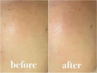 看護師が施術する 美容サロン/元治のエステ・リラクイメージ