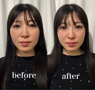 美容鍼灸サロン mahoroba院長のエステ・リラクイメージ