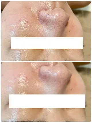 Beauty salon Wish所属・脱毛🌈肌質改善🌈 Wishのエステ・リラクイメージ