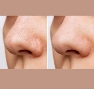 美肌脱毛サロン muroのエステ・リラクイメージ