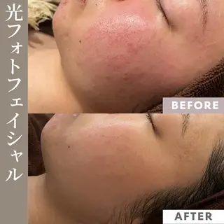 【フェムケア専門店】 PEQLIAヒロミのエステ・リラクイメージ