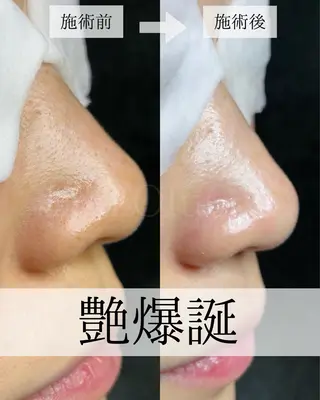 毛穴汚れ改善専門店/ 岸和田/リヒオルオルのエステ・リラクイメージ