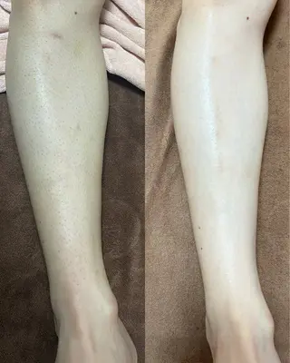 都度払い制脱毛サロンBe Charm所属・Be Charm 山﨑のエステ・リラクイメージ