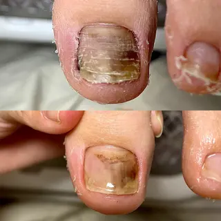 ネイル rangrang nailのネイルデザイン