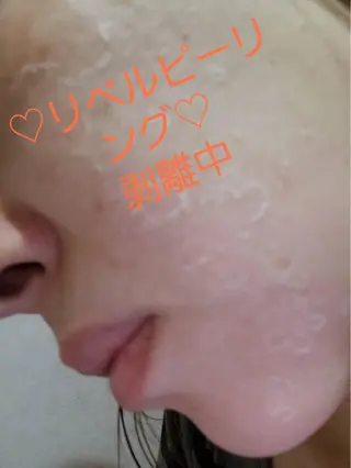 【リベルハーブピーリング認定店】敏感肌・美白脱毛専門店Dione立川店所属・Dione 立川店のエステ・リラクイメージ