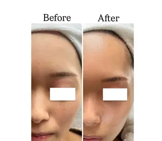 ROR Akariのエステ・リラクイメージ