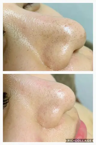 セミロング カラー パーマ ヘアアレンジ メンズ キッズ ネイル マツエク・マツパ 肌質体質を変えて すっぴん肌にのエステ・リラクイメージ