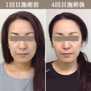 美容整体サロン Chare人形町店のエステ・リラクイメージ