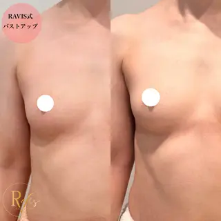 beautysalon RAVIS所属・東大阪/韓国肌管理/ 痩身バスト専門店のエステ・リラクイメージ