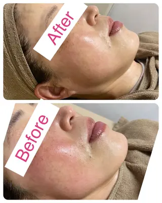 サロンドチェリー 《我妻》のエステ・リラクイメージ