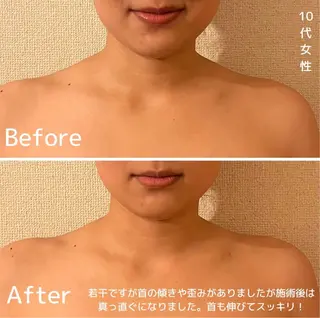 表情筋フェイシャル 三軒茶屋のエステ・リラクイメージ