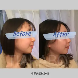 TIARABO 小顔特化美容鍼のエステ・リラクイメージ