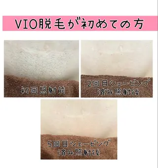 毛穴改善/脱毛 ネイル　川上久仁子のエステ・リラクイメージ