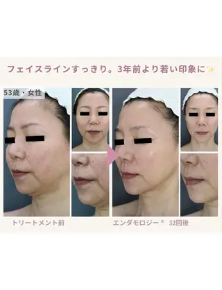 Binosu所属・エンダモロジー BINOSUのその他イメージ