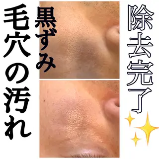 堀井 舞琳のエステ・リラクイメージ