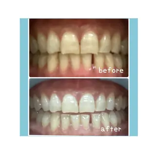 脱毛&フェイシャル BiSTA〈ビスタ〉のエステ・リラクイメージ