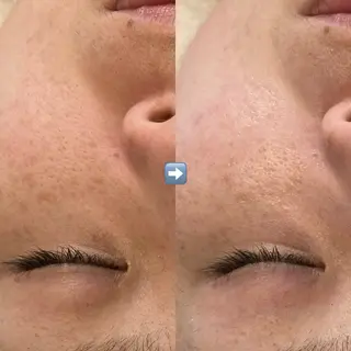 たるみ改善小顔エステ 堀葉月のその他イメージ