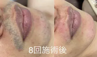 ネフェル所属・ネフェル Neferのエステ・リラクイメージ