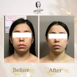 小顔サロンallilin所属・💎allilin 五所川原💎本間のエステ・リラクイメージ