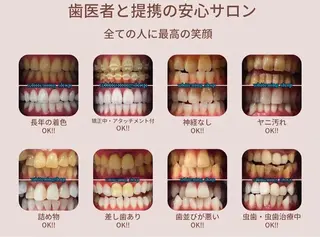 ホワイトニングショップ伊丹店所属・ホワイトニング ショップ伊丹店のその他イメージ