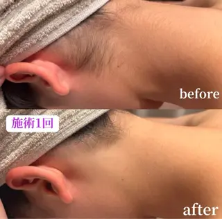 子供脱毛専門サロンReme【リミー】所属・添田 彩葉のエステ・リラクイメージ