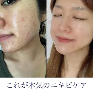 肩首こり×痩身×浄化 🌿リンパエステのエステ・リラクイメージ