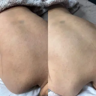 SOIN ボディー リラクゼーションのエステ・リラクイメージ