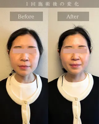 Noelie所属・美肌&小顔矯正 Noelieのエステ・リラクイメージ