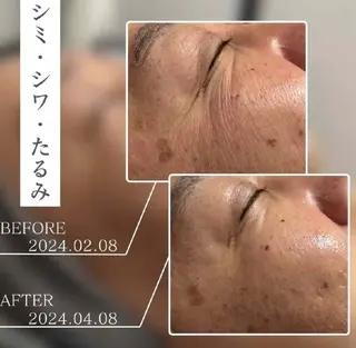 マツエク・マツパ aliaハイフ&水光ジェットサロン所属・aliaハーブ水光店 エステティシャン募集のエステ・リラクイメージ