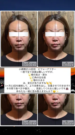 💎後悔させない小顔 矯正💎イトヤマ🌱のエステ・リラクイメージ