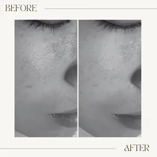 GranDir所属・GranDir 堀井美沙のエステ・リラクイメージ