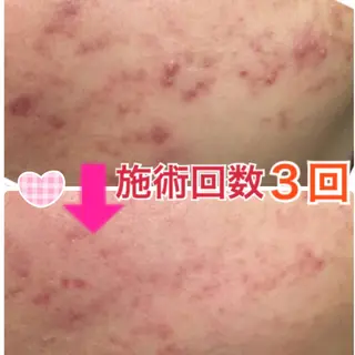 ショート カラー パーマ ヘアアレンジ メンズ キッズ ネイル マツエク・マツパ ‍痩身＆ボディ 結果出し🌟丹野のエステ・リラクイメージ