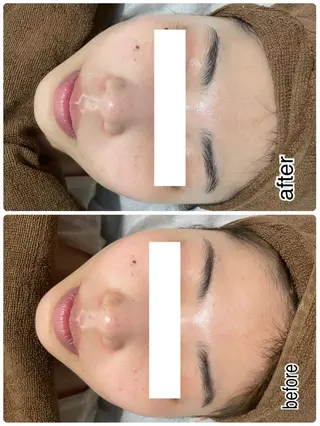 ENCHANT 脱毛.小顔.毛穴のエステ・リラクイメージ