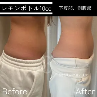 Beauty salon BELLE所属・Beauty salonBELLEのエステ・リラクイメージ