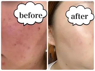 Toujours所属・Toujours トゥジュールのエステ・リラクイメージ