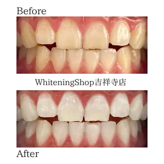 ホワイトニング ショップ吉祥寺店のエステ・リラクイメージ