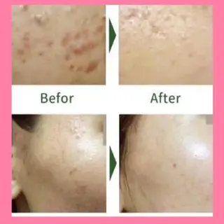 肌ケア＆毛穴洗浄 Cheriのエステ・リラクイメージ