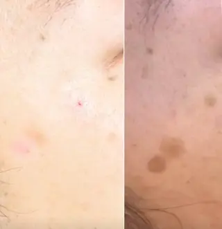 毛穴シミ改善専門 サロンド・ルパークのエステ・リラクイメージ