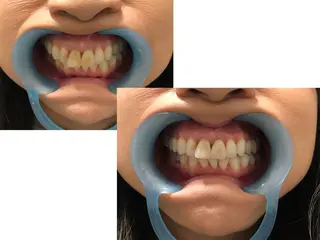 ミディアム ヘアアレンジ ネイル カラー メンズ マツエク・マツパ パーマ キッズ アイブロウ 中目黒 ホワイトニングサロンのその他イメージ