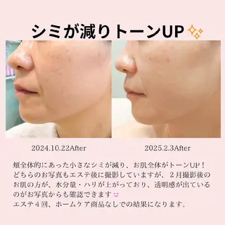 PRETTIEST SHINE所属・フェイシャル/ボディ /ブライダル山田浩子のエステ・リラクイメージ