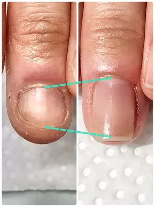 ネイル プライベートネイルサロンPause(ポーズ)所属・自爪育成ネイルサロン Pause(ポーズ)のネイルデザイン