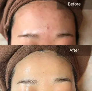 ALIA Scintiller  アリアサンティエ所属・齋藤 祐里耶のエステ・リラクイメージ