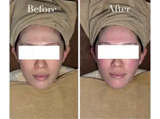 Avenir Brillant所属・松田 紗季のエステ・リラクイメージ