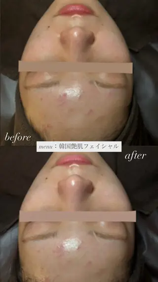 chouchou【シュシュ】所属・トータルボディケア chouchouのエステ・リラクイメージ