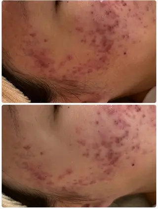 メンズ キッズ 美肌脱毛エステサロン Luangeのエステ・リラクイメージ