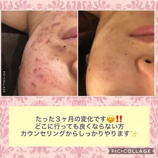 ミディアム カラー パーマ ヘアアレンジ メンズ キッズ ネイル マツエク・マツパ ニキビ・肌質改善専門 ♡人生が変わるサロンのエステ・リラクイメージ